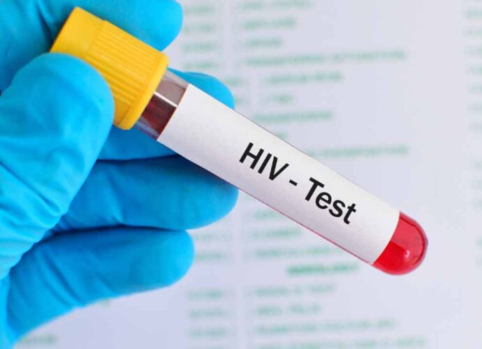 উদ্বেগজনক তথ্য: পূর্ব বর্ধমানে আক্রান্ত ৯০, শুধু বর্ধমান শহরেই ৩০ জন উচ্চশিক্ষিত যুবকের শরীরে এইচআইভি শনাক্ত