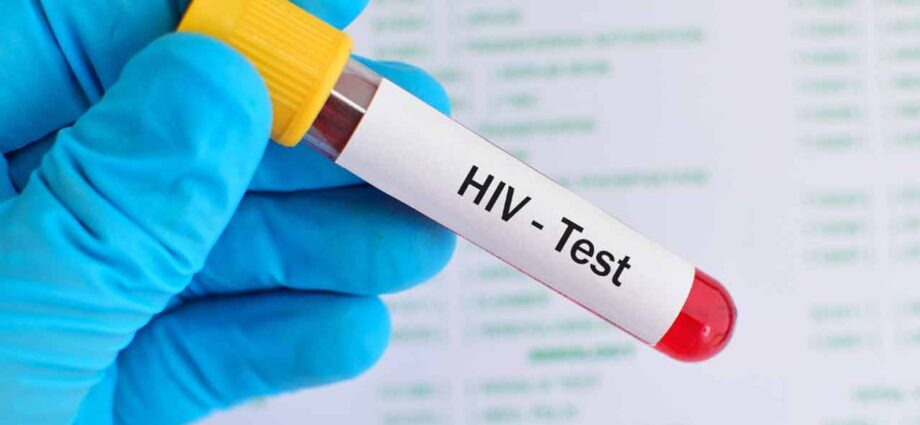 উদ্বেগজনক তথ্য: পূর্ব বর্ধমানে আক্রান্ত ৯০, শুধু বর্ধমান শহরেই ৩০ জন উচ্চশিক্ষিত যুবকের শরীরে এইচআইভি শনাক্ত