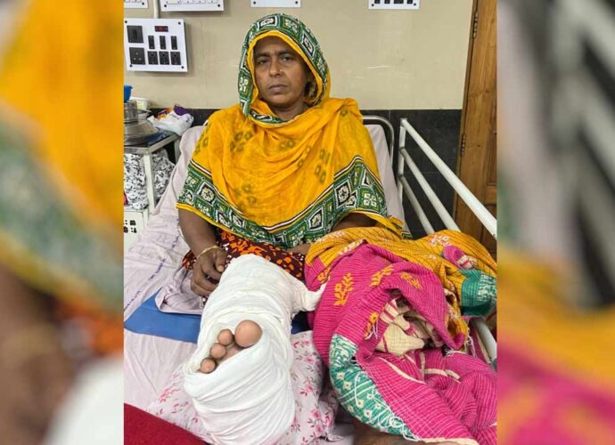 এসএসকেএমে চিকিৎসা বিজ্ঞানের নয়া সাফল্য: বিনা খরচে গোড়ালির ‘আর্থ্রোস্কোপিক সার্জারি’তে সুস্থ প্রৌঢ়া
