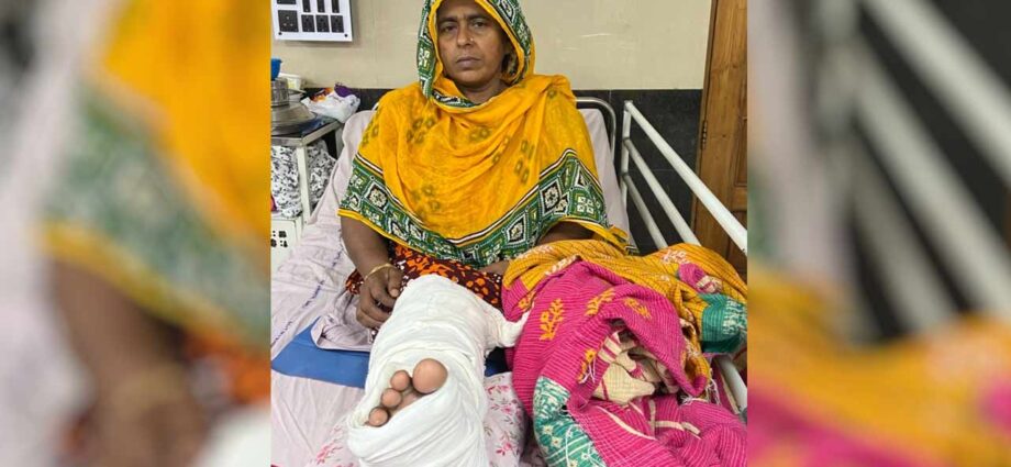 এসএসকেএমে চিকিৎসা বিজ্ঞানের নয়া সাফল্য: বিনা খরচে গোড়ালির ‘আর্থ্রোস্কোপিক সার্জারি’তে সুস্থ প্রৌঢ়া