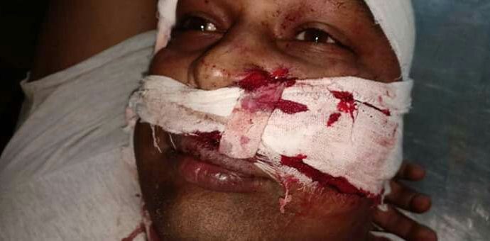 ইতিহাস বিস্মৃত বাঙালির গালে সপাটে থাপ্পড়