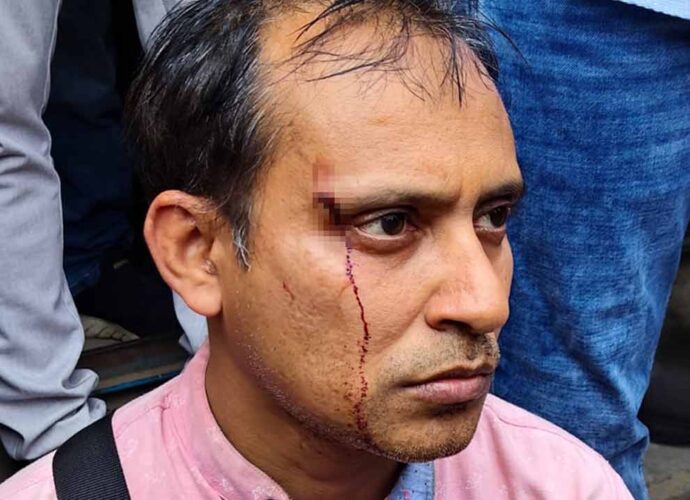 প্রশিক্ষণ কেন্দ্রে ‘মুখ্যমন্ত্রীর প্রচার’, প্রতিবাদী শিক্ষককে ‘মারধর’: বিডিও-কে শোকজ ও দুই কর্মীর বিরুদ্ধে এফআইআর