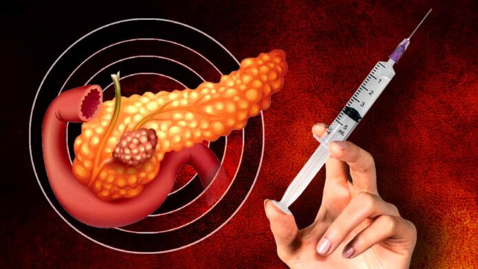 অগ্ন্যাশয়ের ক্যানসার চিকিৎসায় নতুন আশার আলো: এমআরএনএ প্রযুক্তিতে তৈরি টিকার সাফল্য